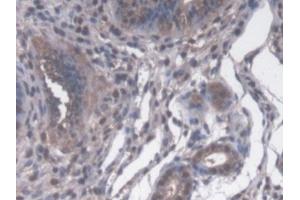 IHC-P analysis of Mouse Uterus Tissue, with DAB staining. (PPID anticorps  (AA 9-189))