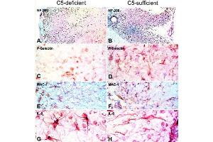 Immunohistochemistry of C5-d and C5-s mice with EAE.