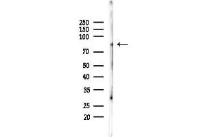 anti-Ankyrin Repeat and Protein Kinase Domain-Containing Protein 1 (ANKK1) (Internal Region) antibody