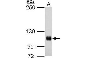 WB Image Rb antibody detects Rb protein by western blot analysis. (Retinoblastoma 1 anticorps  (C-Term))