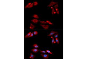 Immunofluorescence (IF) image for anti-GDNF Family Receptor alpha 1 (GFRA1) antibody (ABIN1876561) (GFRA1 anticorps)