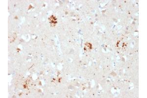 Formalin-fixed, paraffin-embedded human Brain stained with Ubiquitin Mouse Monoclonal Antibody (UBB/2122).