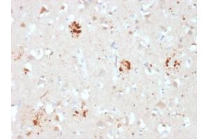 Formalin-fixed, paraffin-embedded human Brain stained with Ubiquitin Mouse Monoclonal Antibody (UBB/2122). (Ubiquitin B anticorps  (AA 1-119))