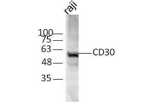 Raji cell lysates probed with Rabbit Anti-CD30 Polyclonal Antibody, Unconjugated  at 1:500 for 90 min at 37˚C.