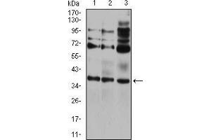 Western blot analysis using CIDEC mouse mAb against HEK293 (1), A431 (2), and HCT116 (3) cell lysate.