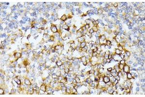 Immunohistochemistry of paraffin-embedded Human tonsil using CAD Polyclonal Antibody at dilution of 1:100 (40x lens).