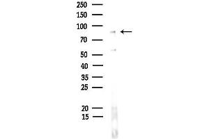 anti-GLIS Family Zinc Finger 3 (GLIS3) (Internal Region) antibody