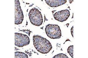 IHC analysis of SAP130 using anti-SAP130 antibody (ABIN7601247). (SAP130 anticorps  (AA 309-913))