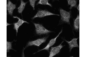 Immunofluorescent staining of HeLa (ATCC CCL-2) cells.