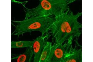 ICC/IF test of HeLa cells treated with sodium butyrate using recombinant H3K27ac antibody (red). (Recombinant Histone 3 anticorps  (acLys27))
