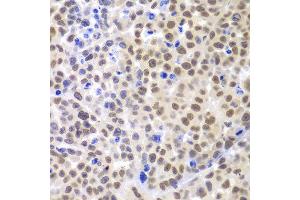 Immunohistochemistry of paraffin-embedded mouse cancer using LHX4 antibody at dilution of 1:100 (x400 lens).