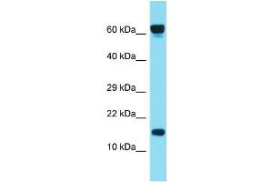 Host: Rabbit Target Name: C1orf86 Sample Type: ACHN Whole cell lysates Antibody Dilution: 1. (C1orf86 anticorps  (C-Term))