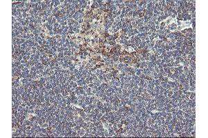 Image no. 15 for anti-Ubiquitin-Conjugating Enzyme E2, J1, U (UBE2J1) antibody (ABIN1501638)