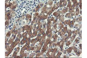 Image no. 2 for anti-Formiminotransferase Cyclodeaminase (FTCD) antibody (ABIN1496378)