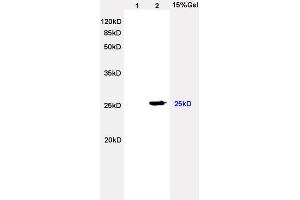 L2 rat heart lysates probed with Anti Lambda Light Chain Polyclonal Antibody, Unconjugated (ABIN704321) at 1:200 overnight at 4 °C. (Lambda-IgLC anticorps  (AA 41-106))