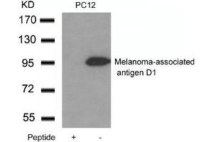 Western blot analysis of extracts from PC12 cells using Melanoma-associated antigen D1 Antibody and the same antibody preincubated with blocking peptide. (MAGED1 anticorps)