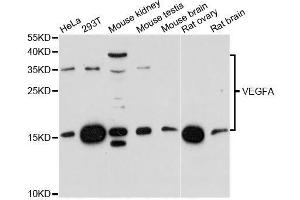 Western blot analysis of extracts of various cell lines, using VEGFA antibody. (VEGFA anticorps  (AA 111-161))