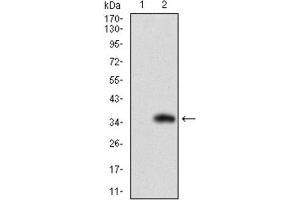 Western Blotting (WB) image for anti-Solute Carrier Family 27 (Fatty Acid Transporter), Member 2 (SLC27A2) (AA 346-405) antibody (ABIN1845739)