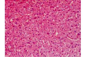 Human Liver: Formalin-Fixed, Paraffin-Embedded (FFPE) (Liver Arginase anticorps  (AA 1-145))