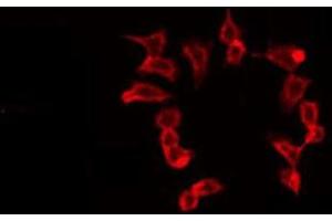 ABIN6275682 staining 293 by IF/ICC. (WASF2 anticorps  (Internal Region))