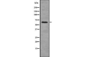 Western blot analysis of P2RX7 using Jurkat whole cell lysates