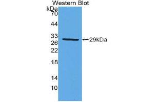 Western Blotting (WB) image for anti-Damage-Specific DNA Binding Protein 2, 48kDa (DDB2) (AA 166-383) antibody (ABIN1980395) (DDB2 anticorps  (AA 166-383))