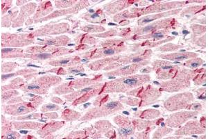 Human Heart (formalin-fixed, paraffin-embedded) stained with JUP antibody ABIN305904 at 5 ug/ml followed by biotinylated anti-goat IgG secondary antibody ABIN481715, alkaline phosphatase-streptavidin and chromogen. (JUP anticorps  (AA 732-745))