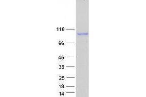 Validation with Western Blot