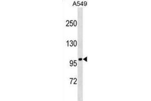 Western Blotting (WB) image for anti-Fanconi Anemia, Complementation Group B (FANCB) antibody (ABIN5019480) (FANCB anticorps)