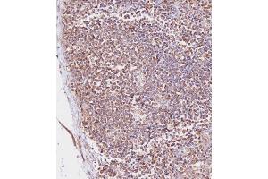 Immunohistochemical analysis of (ABIN657900 and ABIN2846851) on paraffin-embedded Human lymph node tissue. (CD163L1 anticorps  (C-Term))