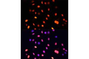 Immunofluorescence analysis of C6 cells using Pan DiMethyl-lysine antibody (ABIN7266777) at dilution of 1:100. (Dimethyl-Lysine anticorps)