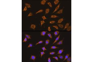 Immunofluorescence analysis of L929 cells using Kininogen 1 (Kininogen 1 (KNG1)) Rabbit pAb (ABIN3022363, ABIN3022364, ABIN3022365 and ABIN6218762) at dilution of 1:100 (40x lens). (KNG1 anticorps  (AA 148-427))