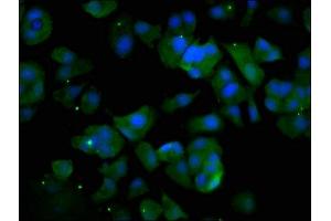 Immunofluorescence staining of MCF-7 cells with ABIN7174426 at 1:133, counter-stained with DAPI.