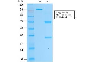 SDS-PAGE Analysis Purified PSAP Mouse Monoclonal Antibody (rACPP/1338). (Recombinant ACPP anticorps)