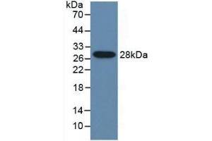 WB of Protein Standard: different control antibodies against Highly purified E. (CYP2E1 Kit ELISA)