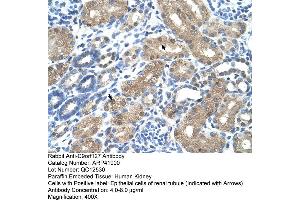 Rabbit Anti-C9orf127 Antibody  Paraffin Embedded Tissue: Human Kidney Cellular Data: Epithelial cells of renal tubule Antibody Concentration: 4. (TMEM8B anticorps  (N-Term))