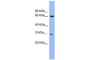 WB Suggested Anti-NDUFS3 Antibody Titration: 0.
