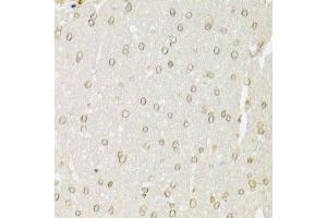 Immunohistochemistry of paraffin-embedded rat brain using XRCC6 Antibody.