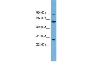 WB Suggested Anti-IMPDH2 Antibody Titration: 0. (IMPDH2 anticorps  (N-Term))