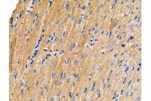 ABIN6257863 and ABIN6275053 at 1/100 staining Rat heart tissue by IHC-P. (DOCK1 anticorps  (C-Term))