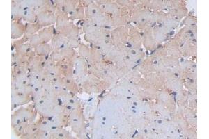 Detection of SDC1 in Rat Heart Tissue using Polyclonal Antibody to Syndecan 1 (SDC1)