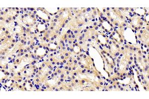 Detection of CHEM in Rat Kidney Tissue using Polyclonal Antibody to Chemerin (CHEM) (CHEM (AA 25-152) anticorps)