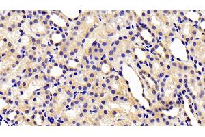 Detection of CHEM in Rat Kidney Tissue using Polyclonal Antibody to Chemerin (CHEM) (Chemerin anticorps  (AA 25-152))