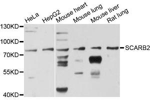 Western blot analysis of extracts of various cell lines, using SCARB2 antibody. (SCARB2 anticorps)
