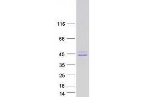 Validation with Western Blot