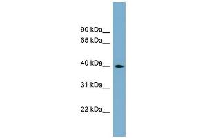 WB Suggested Anti-TSPAN17 Antibody Titration:  0. (Tetraspanin 17 anticorps  (Middle Region))