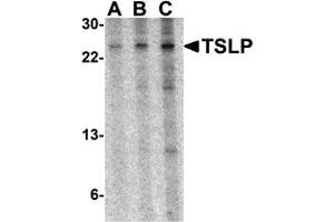 Western Blotting (WB) image for anti-Thymic Stromal Lymphopoietin (TSLP) (Middle Region) antibody (ABIN1031148) (Thymic Stromal Lymphopoietin anticorps  (Middle Region))