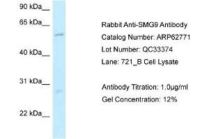 Western Blotting (WB) image for anti-Smg-9 Homolog, Nonsense Mediated mRNA Decay Factor (SMG9) (N-Term) antibody (ABIN971735) (SMG9 anticorps  (N-Term))