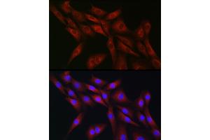 Immunofluorescence analysis of NIH-3T3 cells using CDC42 Rabbit pAb (ABIN3021670, ABIN3021671, ABIN3021672 and ABIN6215499) at dilution of 1:50 (40x lens). (CDC42 anticorps  (AA 25-191))