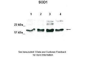 Lanes:   Lane 1: 50ug HeLa lysate Lane 2: 50ug 293T lysate Lane 3: 50ug K562 lysate Lane 4: 50ug MDA-MB-231 lysate  Primary Antibody Dilution:   1:500  Secondary Antibody:   Anti-rabbit-HRP  Secondary Antibody Dilution:   1:1000  Gene Name:   SOD1  Submitted by:   David Colecchia, Ph. (SOD1 anticorps  (N-Term))